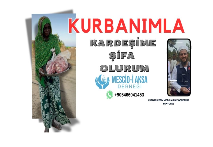 Kardeşime Kurban Olsun